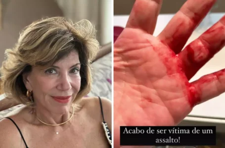 ‘Me estrangulou, rasgou meu dedo’: Silvia Poppovic dá detalhes de assalto